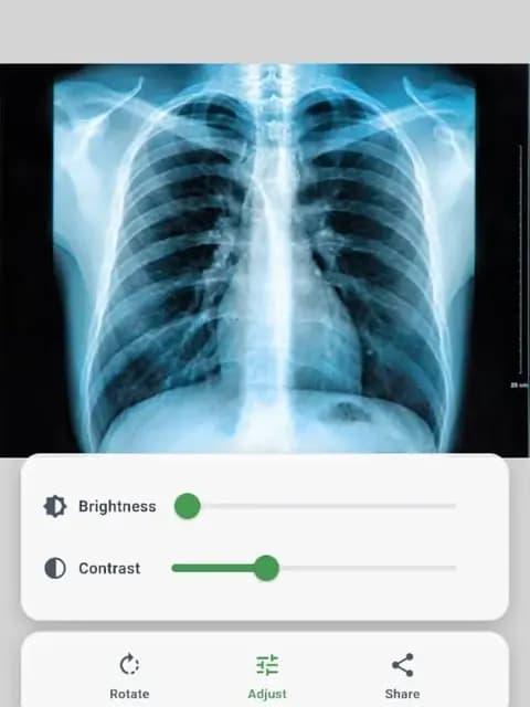 An X-ray record stored in the HospitALL app